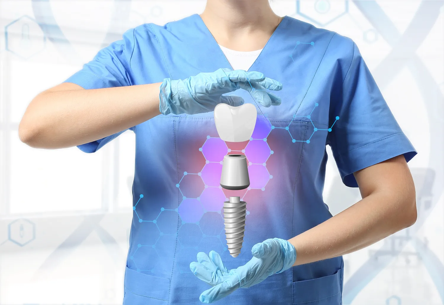 Ile kosztuje jeden implant?