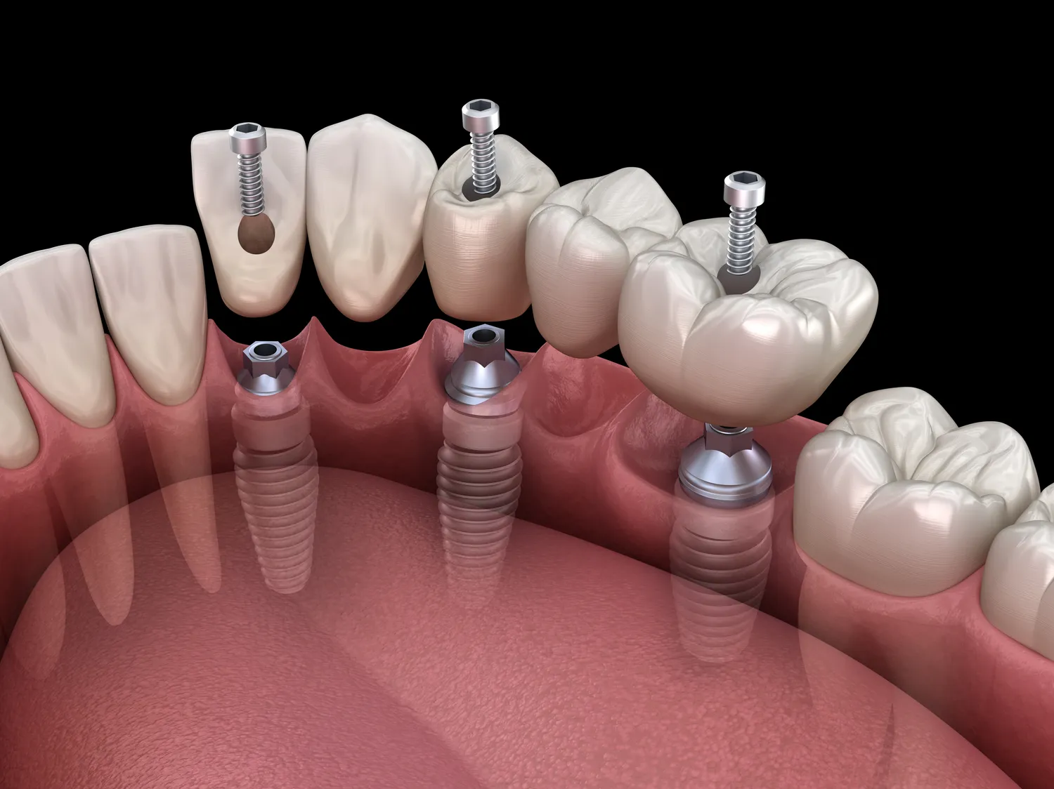Stomatolog czy dentysta?